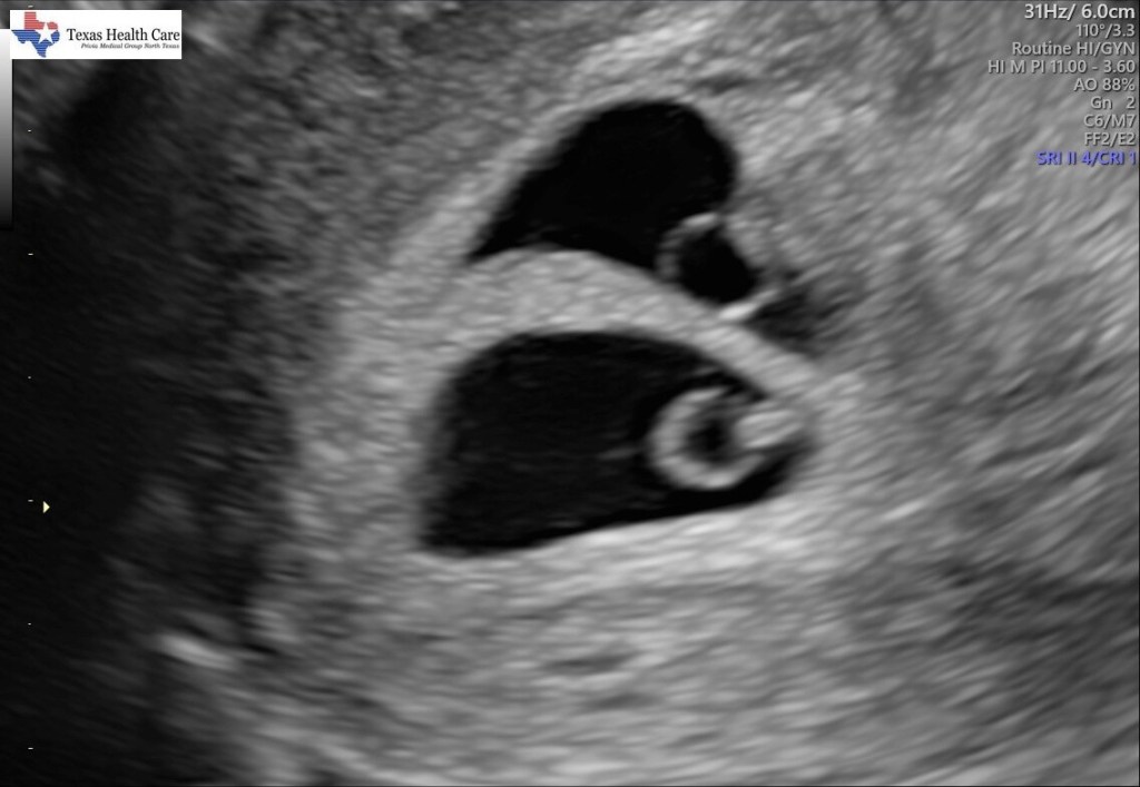How We Went From Not Wanting Kids to Becoming Twin Parents
